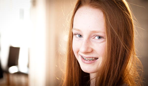 Traditional Metal Braces Clontarf Orthodontics